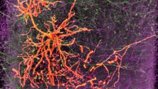 南加州大学脑细胞研究获得美国国立卫生研究院1900万美元拨款