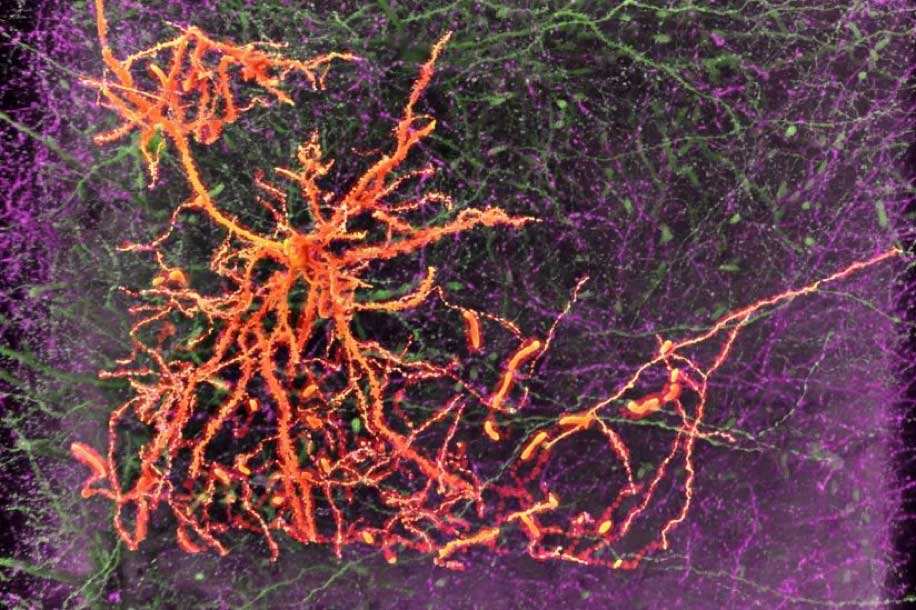 南加州大学脑细胞研究获得美国国立卫生研究院1900万美元拨款