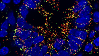 Broad基金会推动南加大及其他高校的多名干细胞科学家、工程师和医生精英齐心协作
