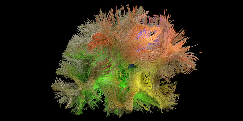 研究人员对特定行为的大脑信号模式进行分离和解码-南加州大学中文官网