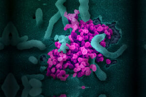 南加大研究重点转为应对新型冠状病毒危机-南加州大学中文官网