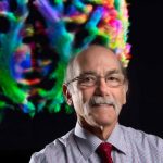 南加州大学顶尖脑科学家尝试攻克阿尔茨海默病