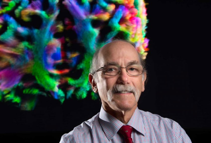 南加州大学顶尖脑科学家尝试攻克阿尔茨海默病