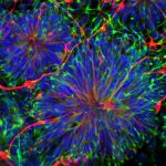 南加大干细胞研究人员的发现正在改变人类生活-南加州大学中文官网
