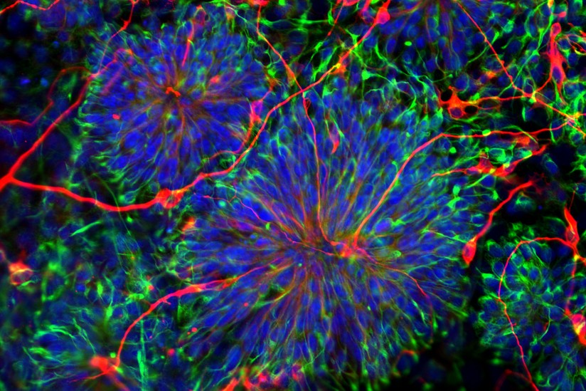 南加大干细胞研究人员的发现正在改变人类生活-南加州大学中文官网